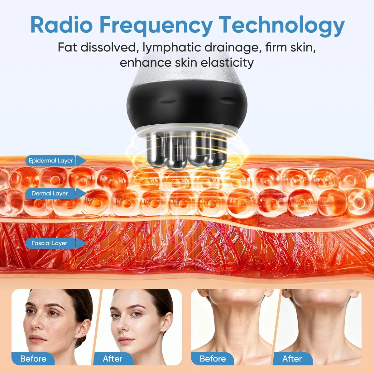40K Appareil de cavitation, Appareil minceur 4 en 1 avec radiofréquence pour le soin du visage, du ventre, des fesses et des cuisses